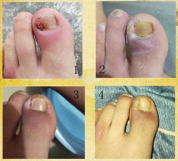 李家堂甲沟炎康复馆